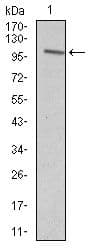 Monoclonal Mouse anti-Human VAV1 / VAV Antibody (clone 2E+11, Amino Acid: 121-324, WB)