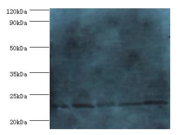 GSTP1 / GST Pi Antibody (aa2-210, FITC)