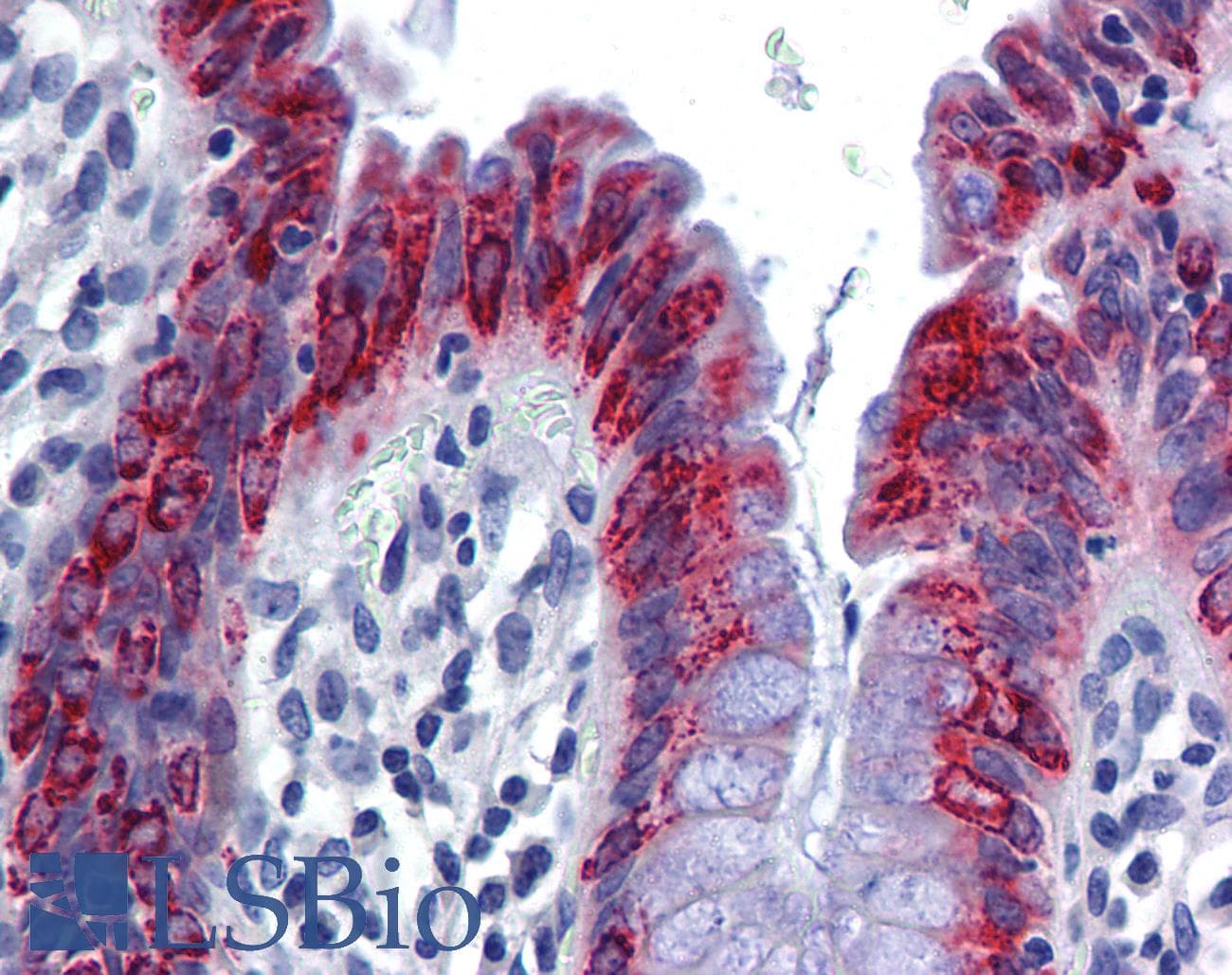PathPlus™ AGR2 Antibody (aa101-150)