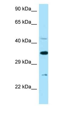 TNFRSF1B / TNFR2 Antibody (aa102-151)