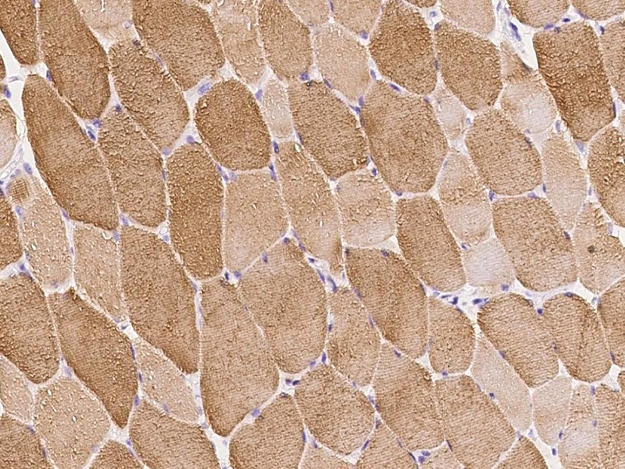MYBPC1 Antibody