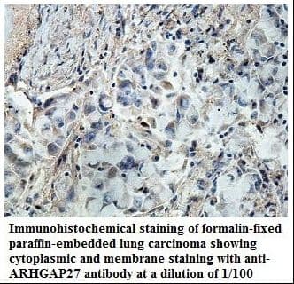 ARHGAP27 Antibody (aa350-548)
