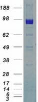 Human DDR2 Protein (Recombinant Myc-DDK (Flag))