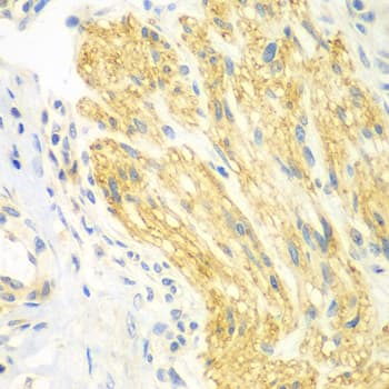 PTK6 / BRK Antibody