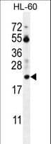 Polyclonal Rabbit anti-Human PTMA / Prothymosin Alpha Antibody (aa1-31, IHC, WB)