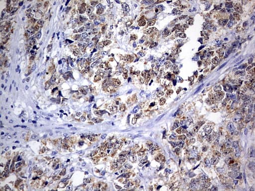 Monoclonal Mouse anti-Human OXSM / KS Antibody (clone OTI4E10, Carrier-free, aa78-343, IHC, WB)