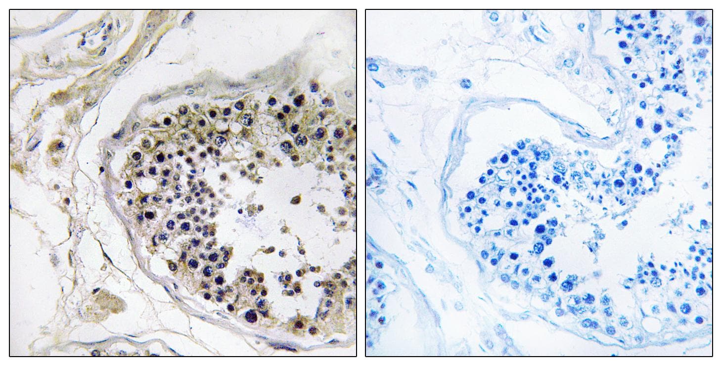CST8 / CRES Antibody