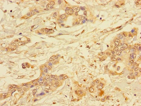 ALG2 Antibody