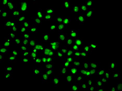 Polyclonal Rabbit anti-Human HMG20A Antibody (IHC, IF, WB)