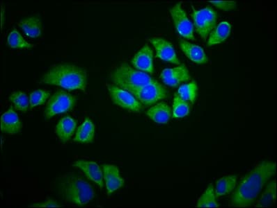 Polyclonal Rabbit anti-Human SCIMP Antibody (IHC, IF)