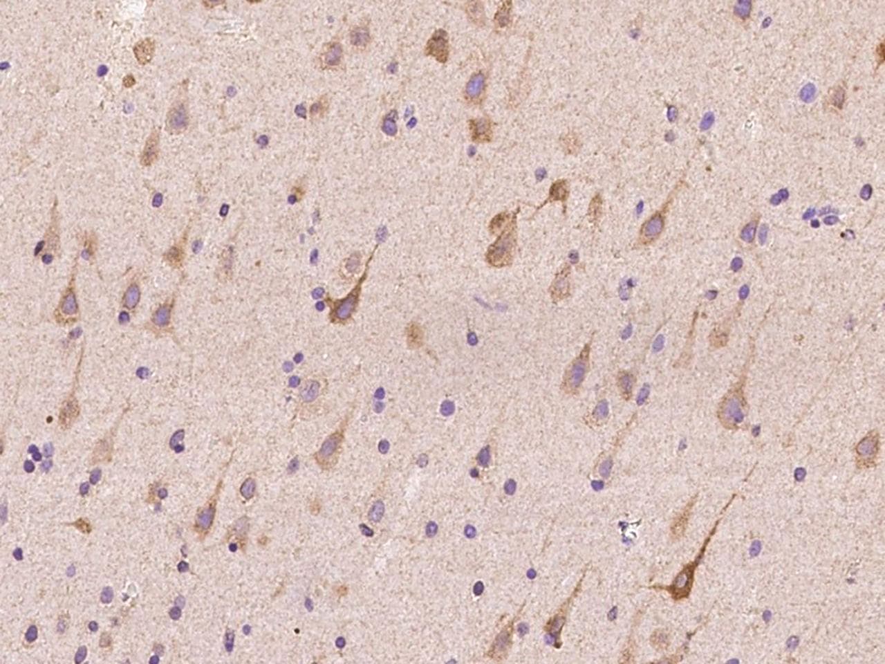 DERL1 / Derlin 1 Antibody