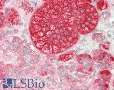 IHC-plus™ Polyclonal Rabbit anti-Human HSPD1 / HSP60 Antibody (aa300-350, IHC, WB)