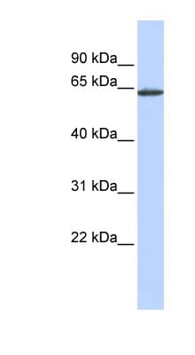 ANTXR1 / TEM8 Antibody (aa396-445)