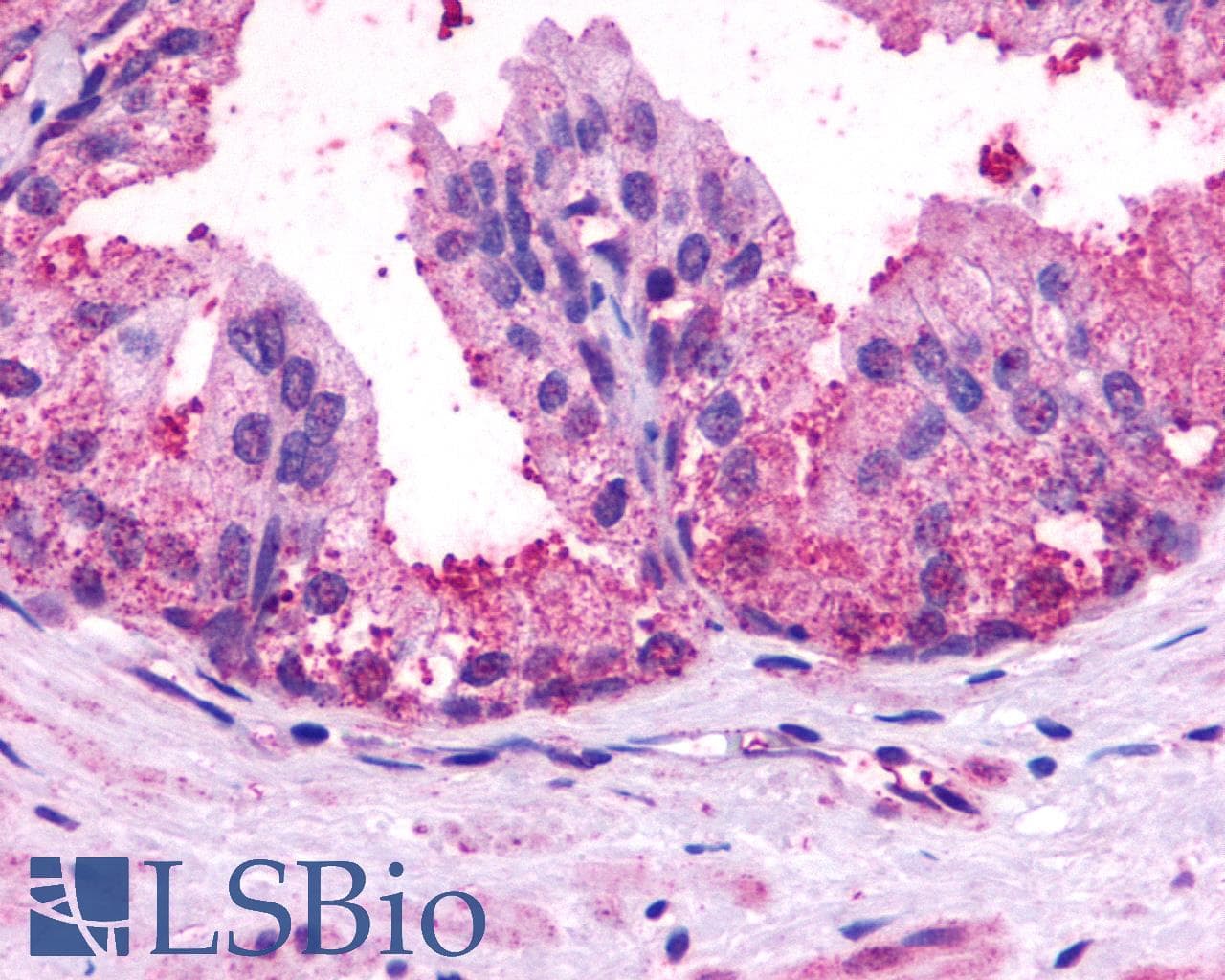 IHC-plus™ Polyclonal Rabbit anti-Human ADGRB1 / BAI1 Antibody (C-Terminus, IHC)