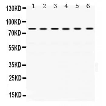 TRAP1 / HSP75 Antibody (aa571-704)