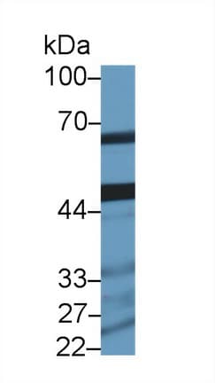 HADHB Antibody (aa1-259, APC)