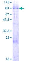 Human PHF1 Protein (Recombinant GST)