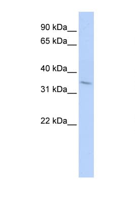 TNFRSF25 / DR3 Antibody (C-Terminus)
