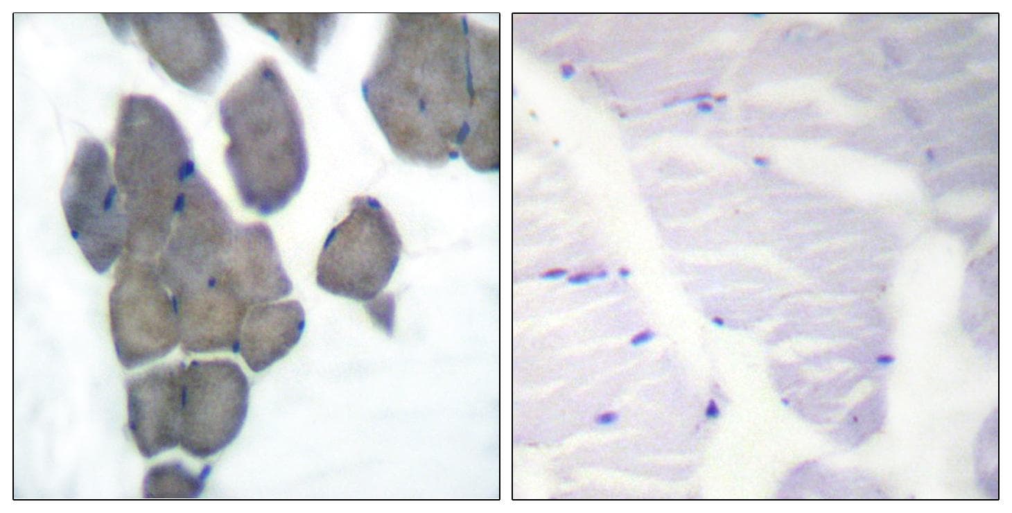Polyclonal Rabbit anti-Human Acetyl-CoA Carboxylase / ACC Antibody (phospho-Ser80, IHC)