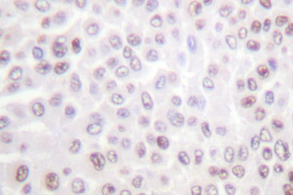 Histone H2B Antibody (Lys5)