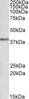 IHC-plus™ PRKCDBP / CAVIN3 Antibody (aa179-190)