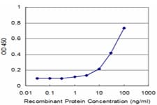 Monoclonal Mouse anti-Human MAGEA1 / MAGE 1 Antibody (clone 3H5, WB)