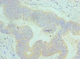 AP50 / AP2M1 Antibody (aa136-435)