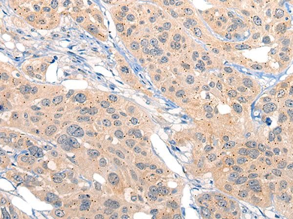 IIP45 / MIIP Antibody