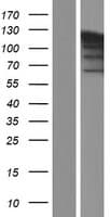 PARP1 Protein (Over-Expression Lysate Myc-DDK (Flag))