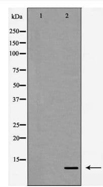 IL8 / Interleukin 8 Antibody