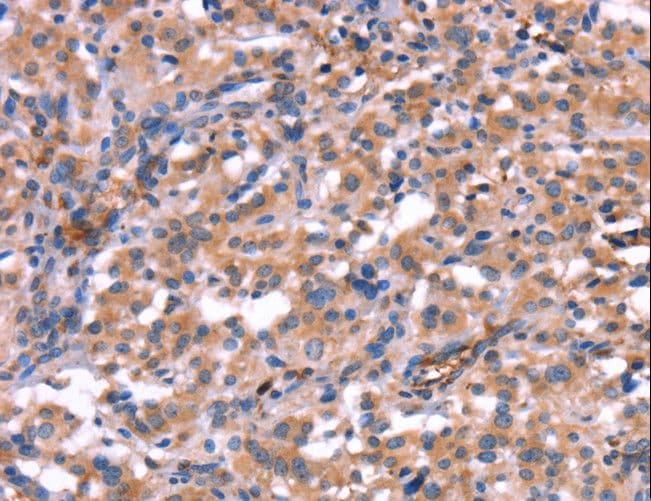 Polyclonal Rabbit anti-Human HMGCS1 / HMG-CoA Synthase 1 Antibody (IHC, WB)