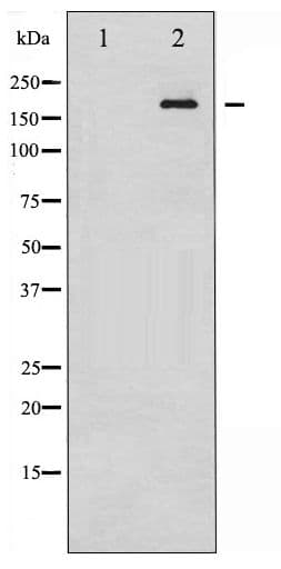 IRS1 Antibody (phospho-Ser312)