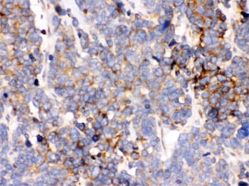 HSPA5 / GRP78 / BiP Antibody