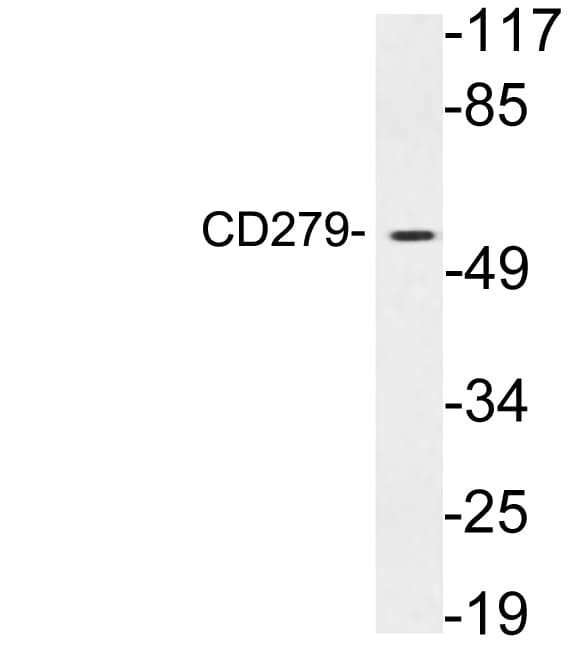 PDCD1 / CD279 / PD-1 Antibody (aa103-152)