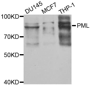 IHC-plus™ Polyclonal Rabbit anti-Human PML Antibody (IHC, IF, WB)