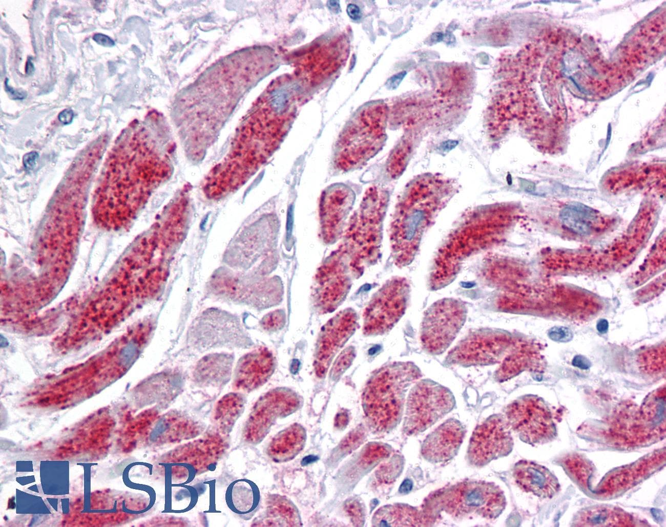 IHC-plus™ Monoclonal Mouse anti-Human IDH2 Antibody (clone 5F11, IHC, WB)