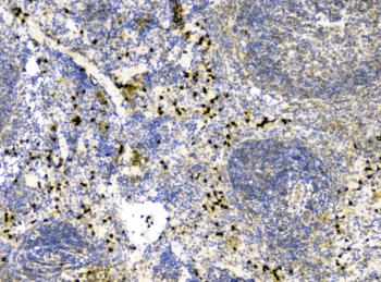 Polyclonal Rabbit anti-Human IL34 Antibody (IHC, WB)