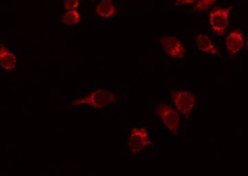 SMO / Smoothened Antibody