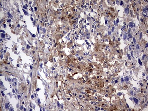 LGALS3 / Galectin 3 Antibody (clone OTI1C7)