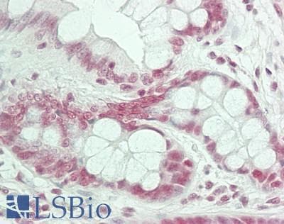 IHC-plus™ Polyclonal Rabbit anti-Human ALY / THOC4 Antibody (aa75-125, IHC)