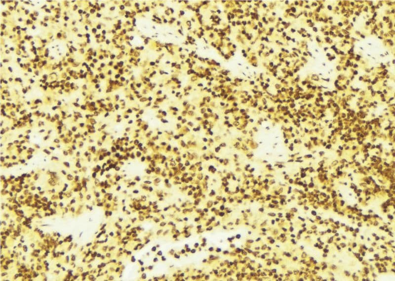 Polyclonal Rabbit anti-Human DOK1 Antibody (IHC, IF, WB)
