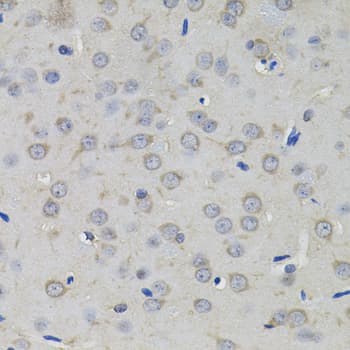 AMPD1 Antibody