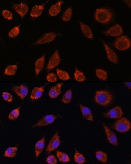 HPS4 Antibody