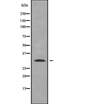 RAB40A / RAR2 Antibody