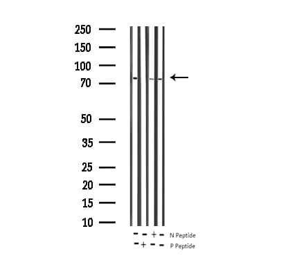 PRKCA / PKC-Alpha Antibody (phospho-Thr638)