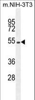 EIF2B4 Antibody (aa146-175)