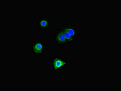 Polyclonal Rabbit anti-Human DOK2 Antibody (IHC, IF, WB)