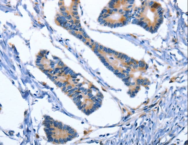 IHC-plus™ Polyclonal Rabbit anti-Human IBSP / Bone Sialoprotein Antibody (IHC)