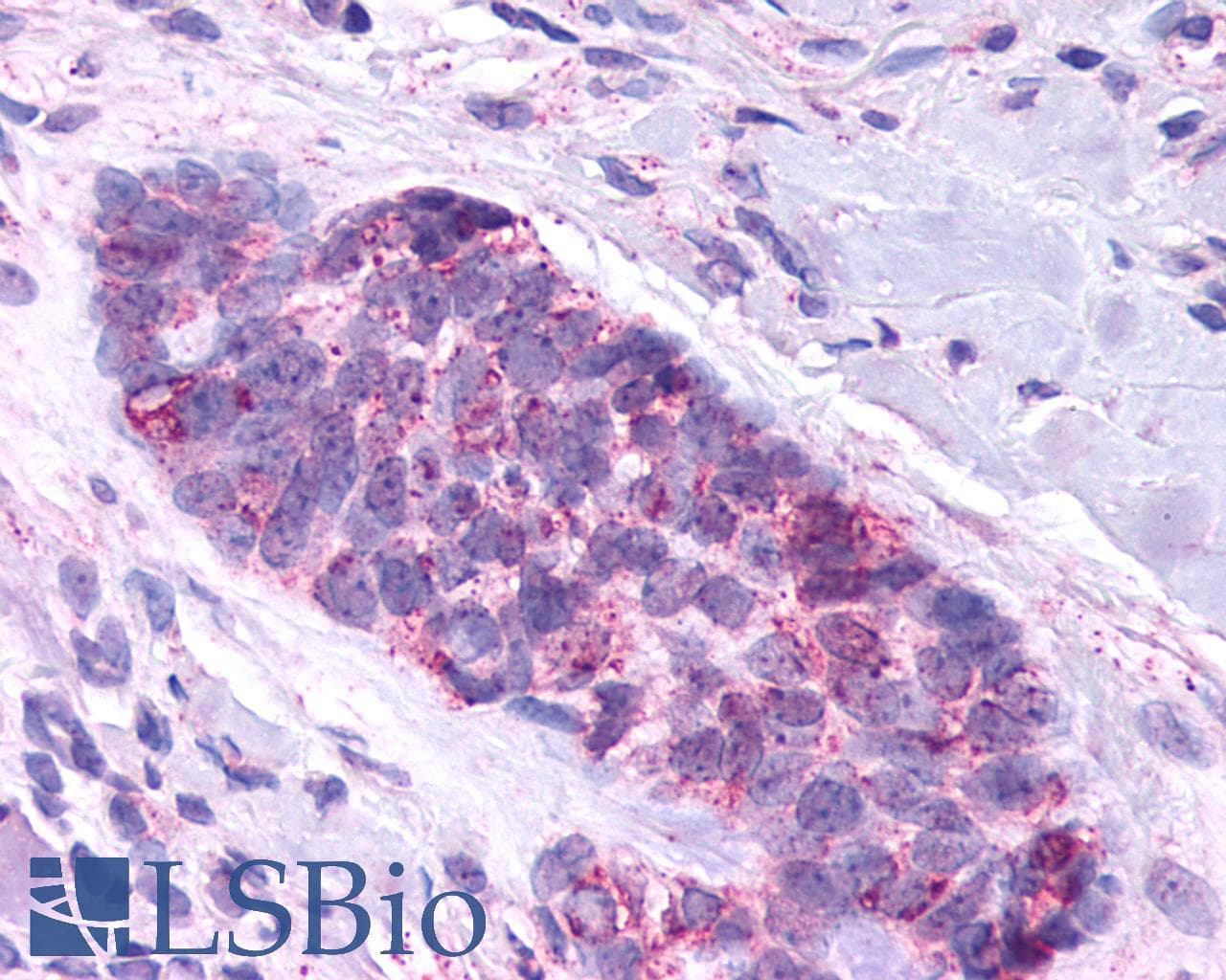 IHC-plus™ Polyclonal Rabbit anti-Human SMO / Smoothened Antibody (1st Extracellular Domain, IHC, IF)