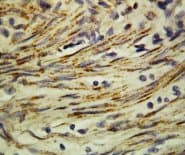 MMP16 Antibody (C-Terminus)